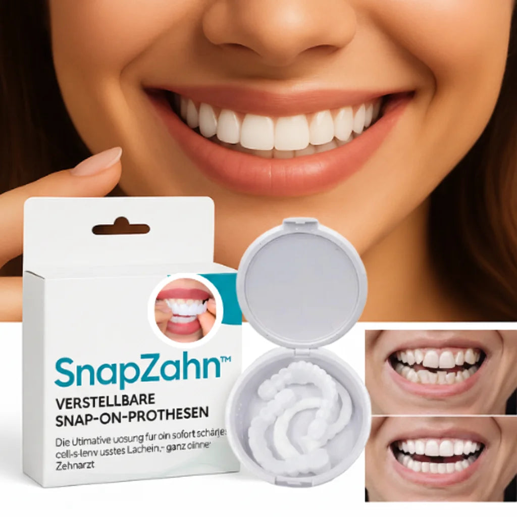 SnapZahn™ | Modulares Veneer-Set (Ober- & Unterkiefer)