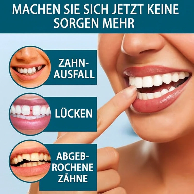 SnapZahn™ | Modulares Veneer-Set (Ober- & Unterkiefer)